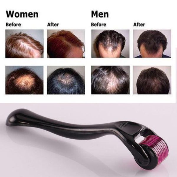 Hair Growth Roller - Image 2